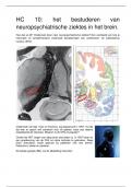 Introduction to neuroscience, samenvatting hoorcollege 10