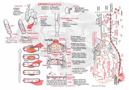 Artherosclerosis Overview