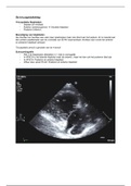 De tricuspidalisklep in echocardiografie