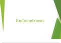 MBBS 101 MBBS endometriosis 1.pptm | Best study material | 100% Guaranteed Pass