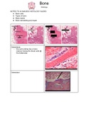 05 bone histology 39 notes to slides / images Class notes MTY1204 (histology)  Junqueira's Basic Histology: Text and Atlas, Fiifteenth Edition, ISBN: 9781260026177