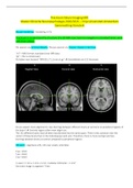 Handige MRI practicum handleiding + uitleg oefenexamen (Neuro-Imaging VU)