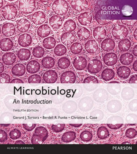 Test Bank - Microbiology: An Introduction  13th Edition By Gerard Tortora , Berdell Funke , Christine Case | Chapter 1 – 28, Complete Guide 2023|