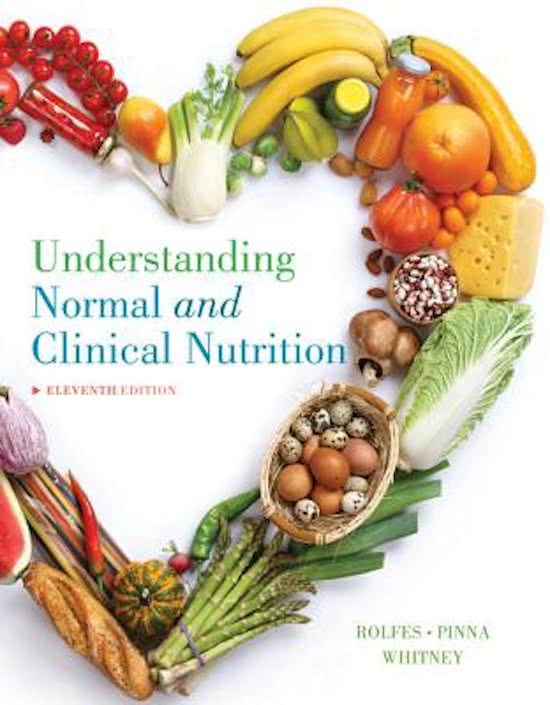 Complete Test Bank Understanding Normal and Clinical Nutrition 11th Edition Rolfes Questions & Answers with rationales (Chapter 1-29)
